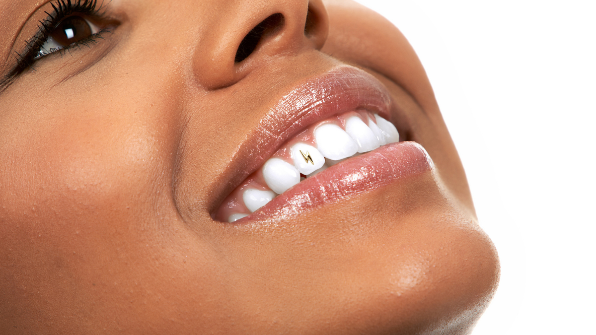 What happens to your tooth when a gem is removed?